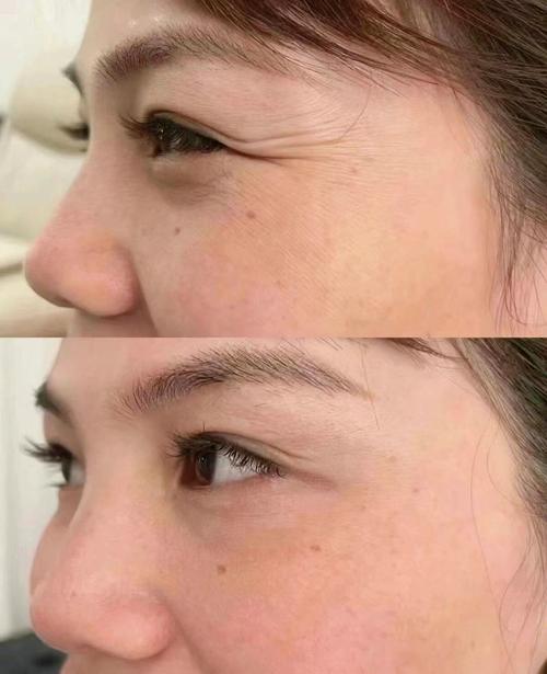 祛皱你不得不看的小妙招